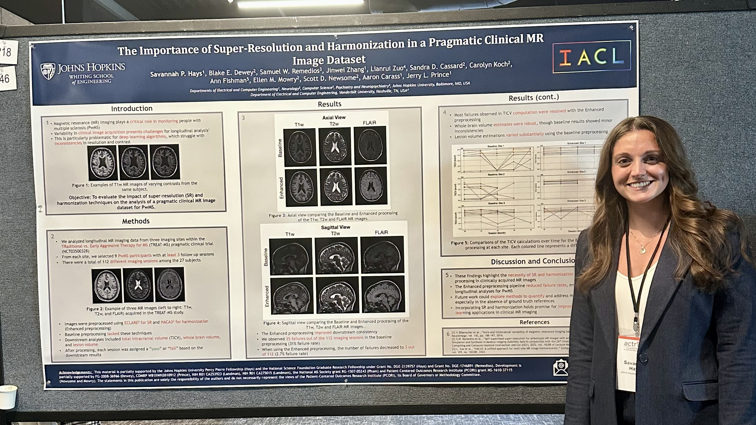 Savannah Hays presenting her award winning poster "The Importance of Super-Resolution and Harmonization in a Pragmatic Clinical MR Image Dataset" at the ACTRIMS Young Scientist Conference 2025.